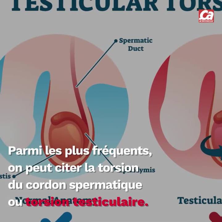 Vimeo CAM - tout savoir sur les testicules.