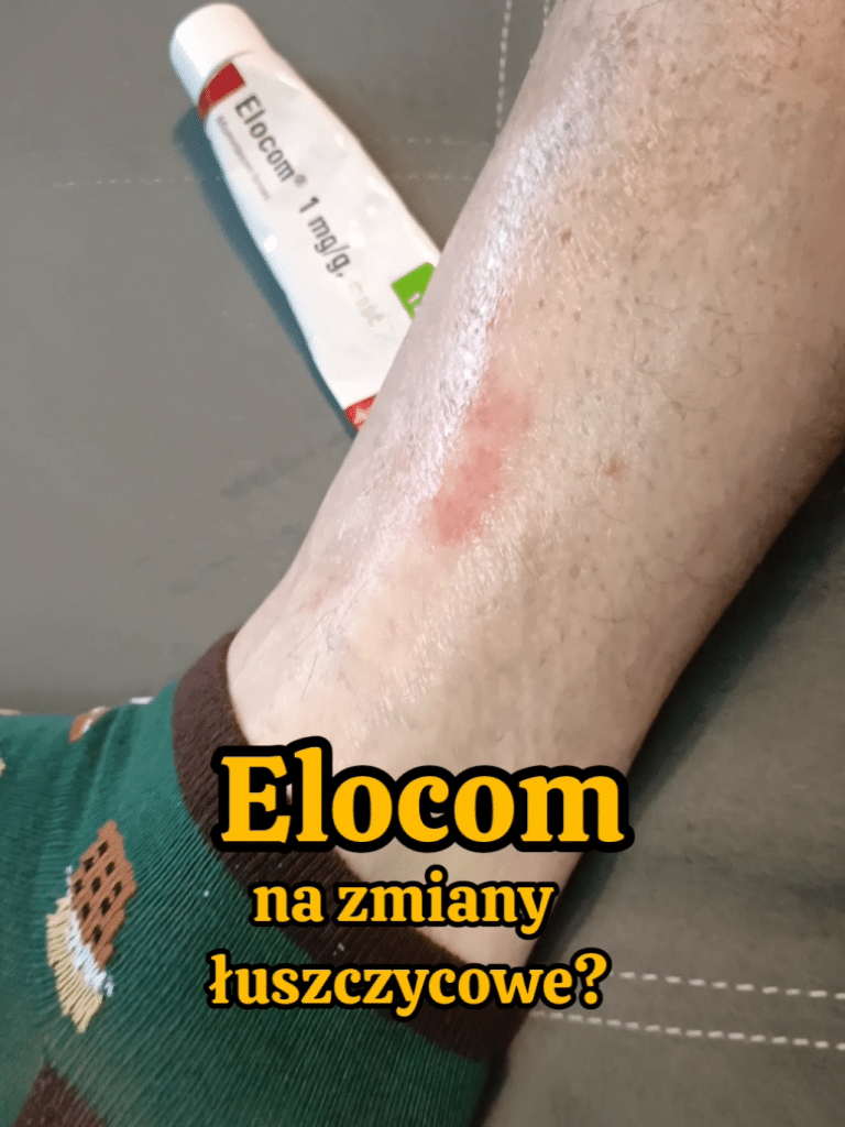 Avez-vous utilisé la pommade Elocom pour des lésions psoriasiques ? Je suis curieux de connaître vos expériences