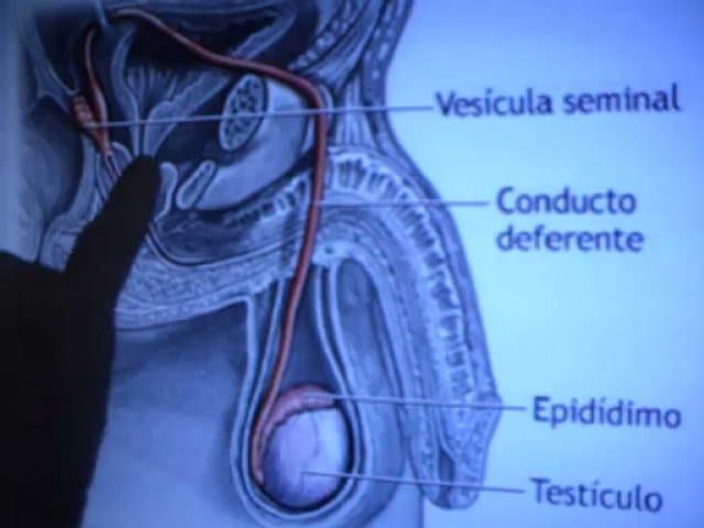 Un orgasme, mille orgasmes dans l'éjaculation précoce