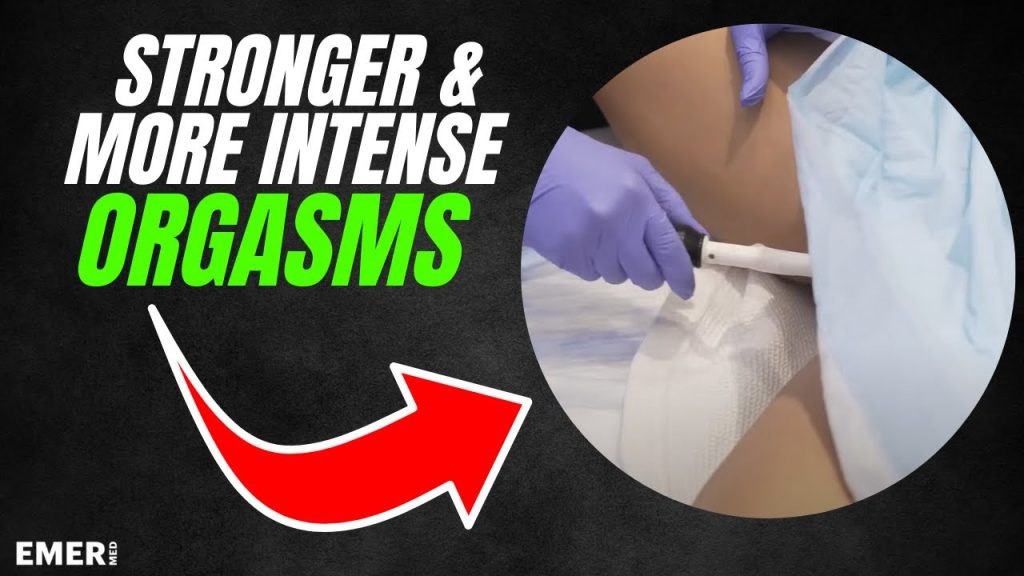 Orgasmes plus forts et meilleurs | Rajeunissement vaginal avec forma v | Dr Jason Emer